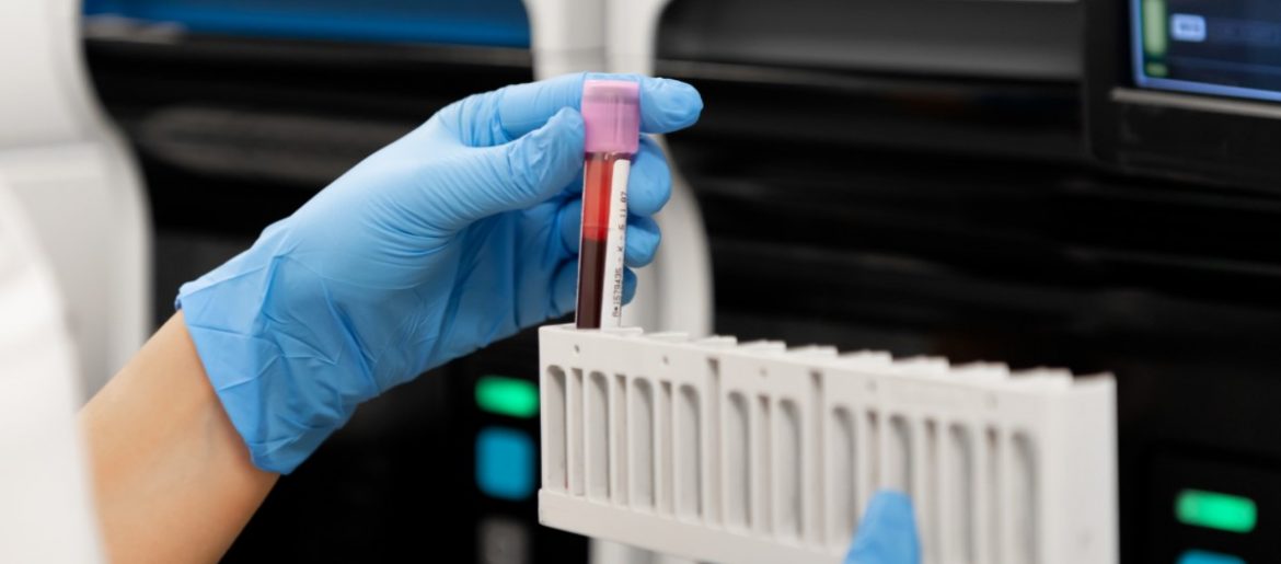 ჰემატოლოგია. მკურნალობა თურქეთში. [ძვლის ტვინის გადანერგვა], [ღეროვანი უჯრედების გადანერგვა], [ლეიკემია], [ლიმფომა], [მიელომა].Last updated 2021